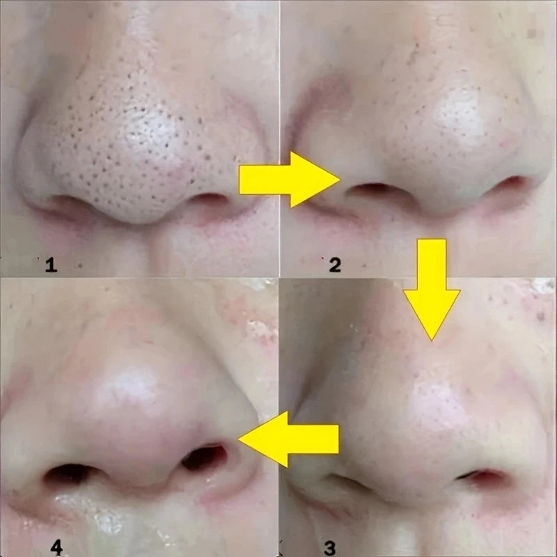 Nose Blackhead Remover Mask Nasal Strips Black Head Nose