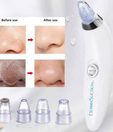 Derma suction Blackhead Remover Vacuum Acne Cleaner Black Spots Removal