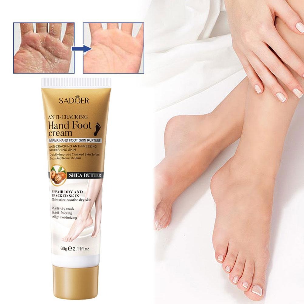 Sadoer Hand Foot Cream – 60gram Hand Foot Cream Moisturizing Calluses Dead Skin Repair Rehydration Soften Cuticle Smooth Restore Feet Care Products