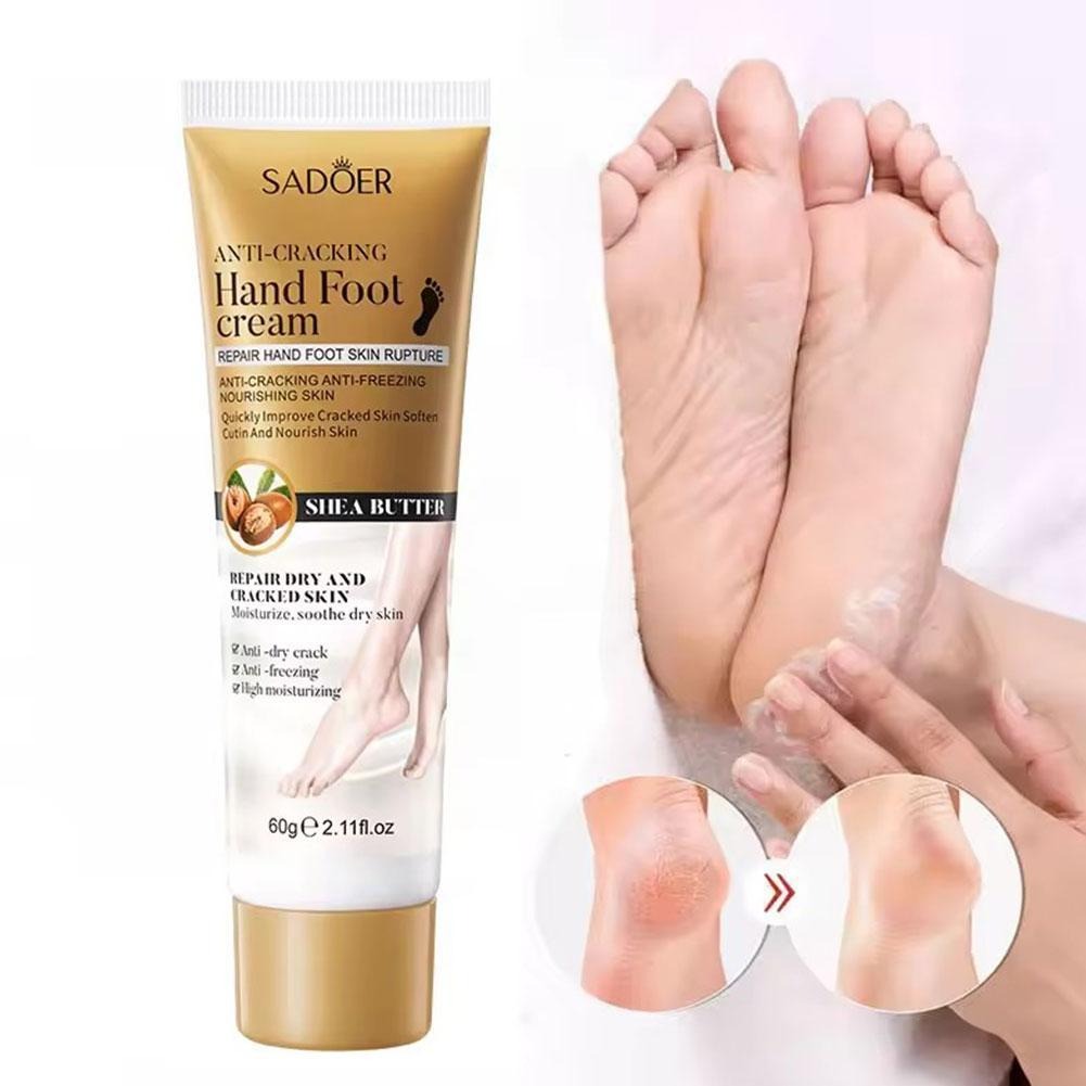 Sadoer Hand Foot Cream – 60gram Hand Foot Cream Moisturizing Calluses Dead Skin Repair Rehydration Soften Cuticle Smooth Restore Feet Care Products
