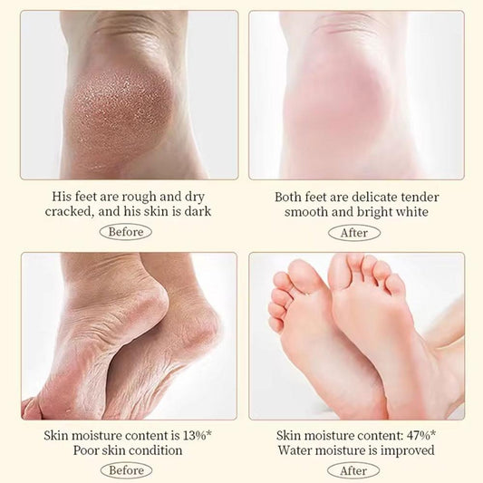Sadoer Hand Foot Cream – 60gram Hand Foot Cream Moisturizing Calluses Dead Skin Repair Rehydration Soften Cuticle Smooth Restore Feet Care Products